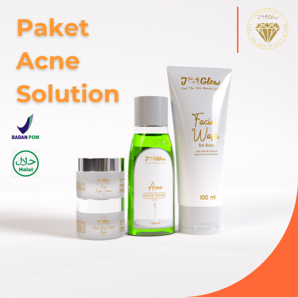 Jual Jglow Skincare Paket Acne Solution Whitening Glowing Cream Skin Paket Perawatan 4pcs 8394