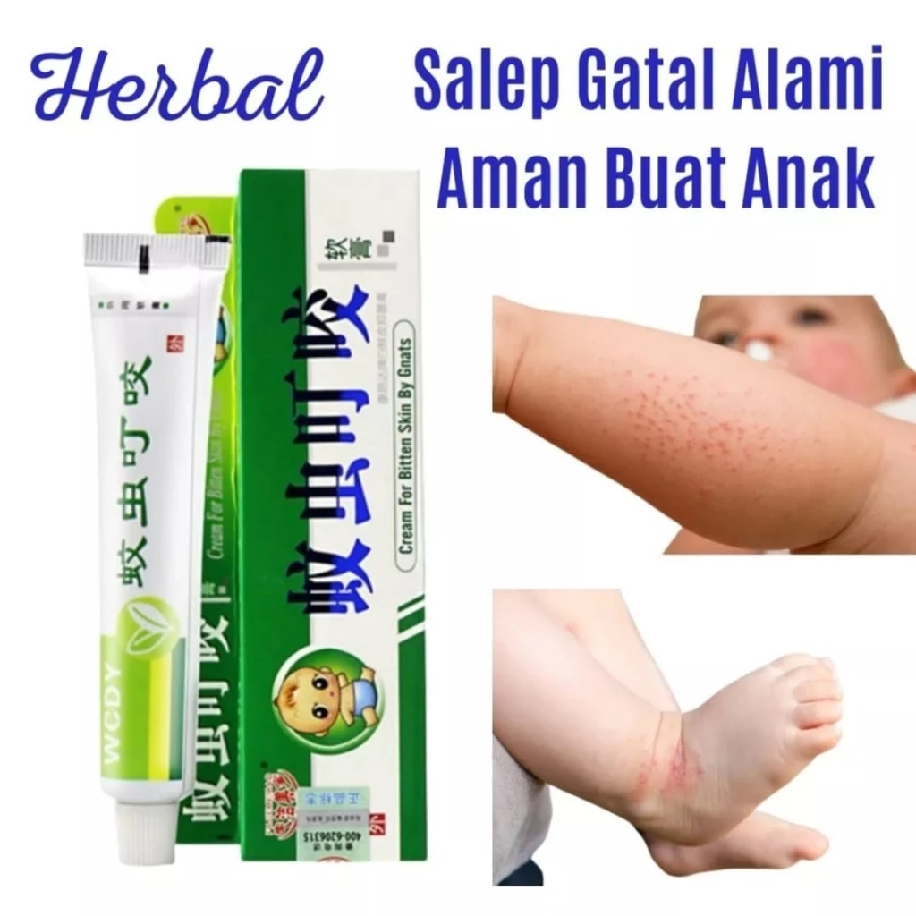 Salep Obat Gatal Anak Bayi Alergi Biang Keringat Panu Ampuh | AutoStock