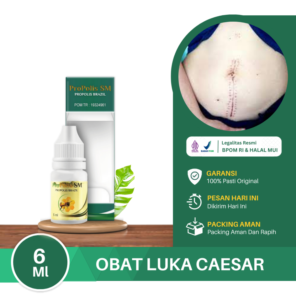 Jual Obat Luka Caesar Luka Sayat Penghilang Luka Pasca Operasi Caesar