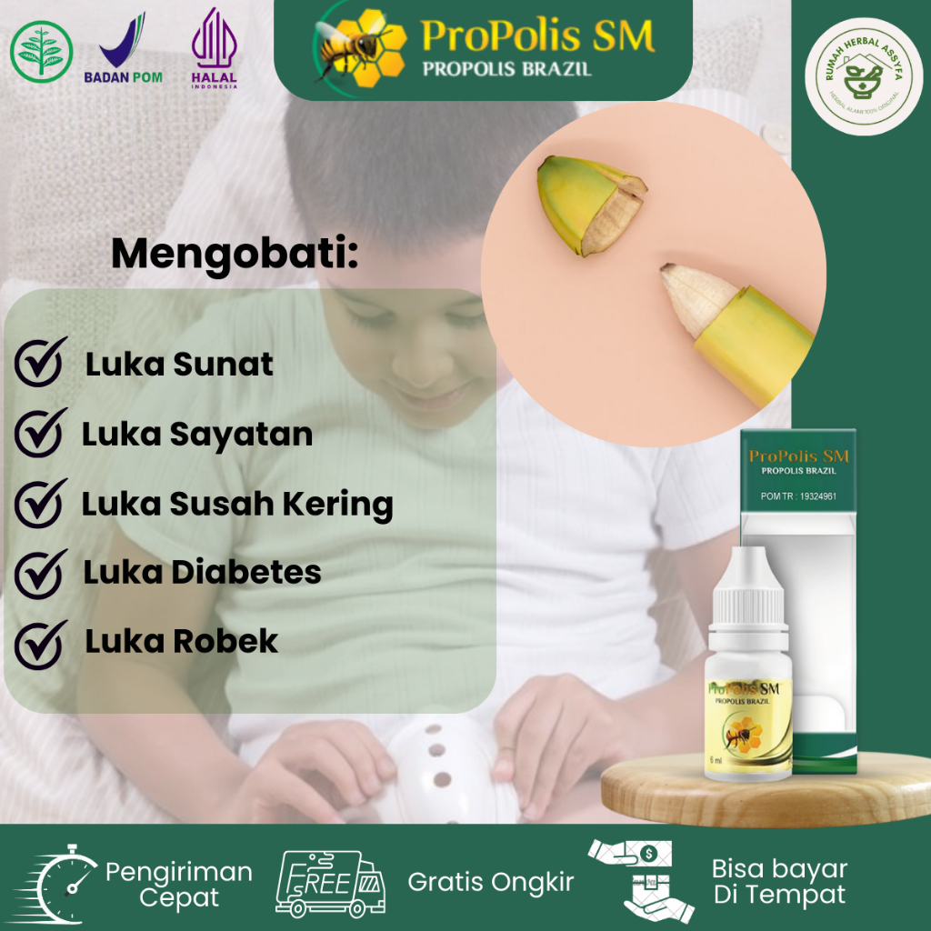 Jual Obat Luka Sunat Pengering Luka Sunat Luka Khitan Uka Sunat Cepat Kering Pengering Luka 