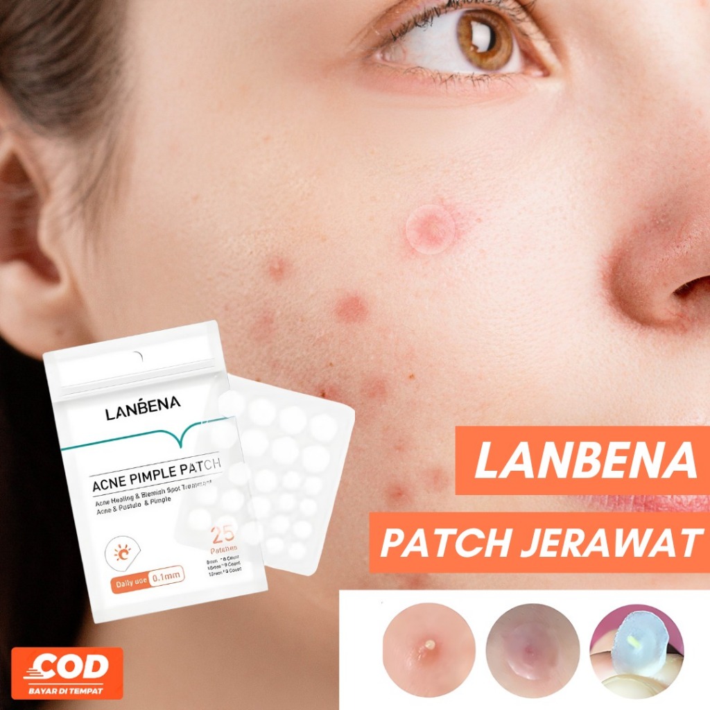 Jual Lanbena Acne Pimple Patch (DAILY NIGHT USE) - Lanbena Stiker ...