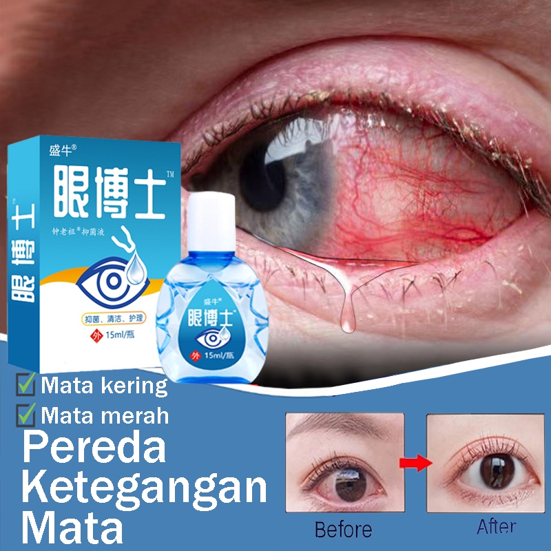 Jual Obat Mata Katarak Tetes Mata Obat Tetes Mata 15ml Darah Merah Mata