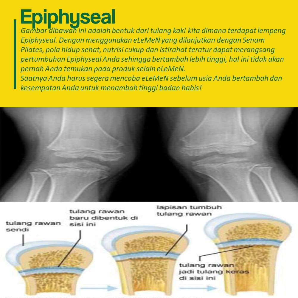 Jual Alat Terapi Peninggi Badan eLeMeN Bantu Mudahkan Kamu Dapat ...