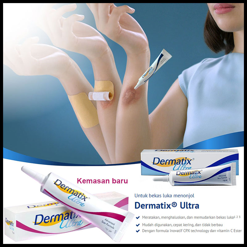 Jual Dermatix Ultra Gel G Penghilang Bekas Luka Keloid Anti Scar Stretchmark Gram