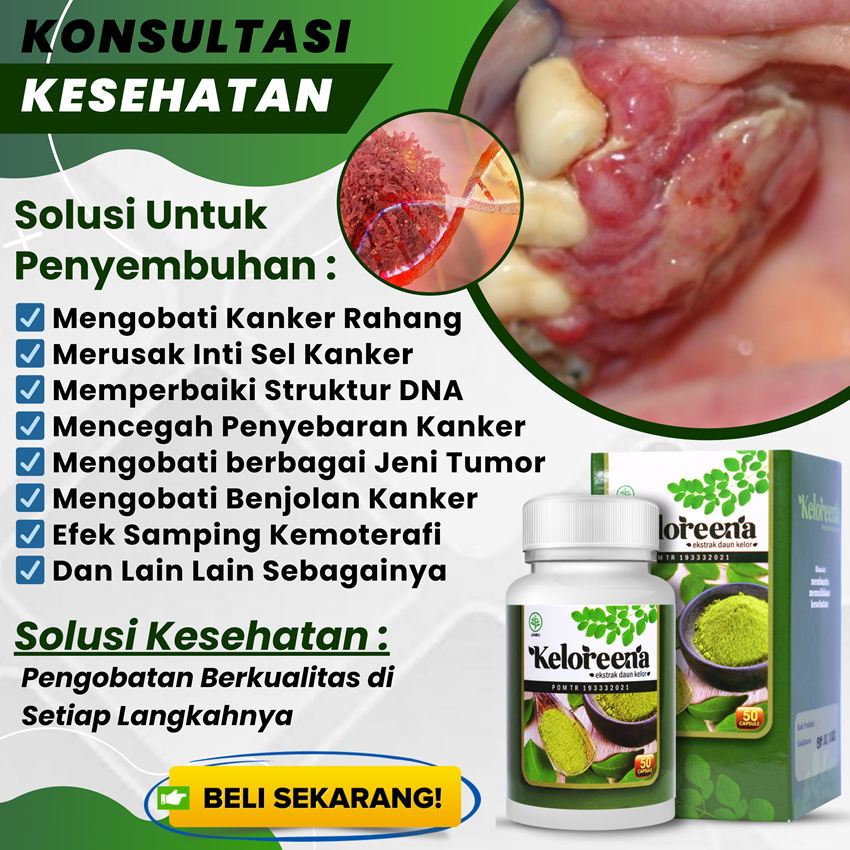 Jual Obat Tumor Rahang Herbal Kanker Dan Tumor Ganas Benjolan Di