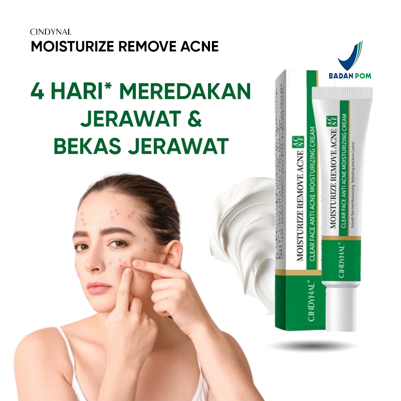 Jual Bpom Cindynal Krim Obat Jerawat Dan Bekas Jerawat Paling Ampuh Cream Moisturize Acne 8210