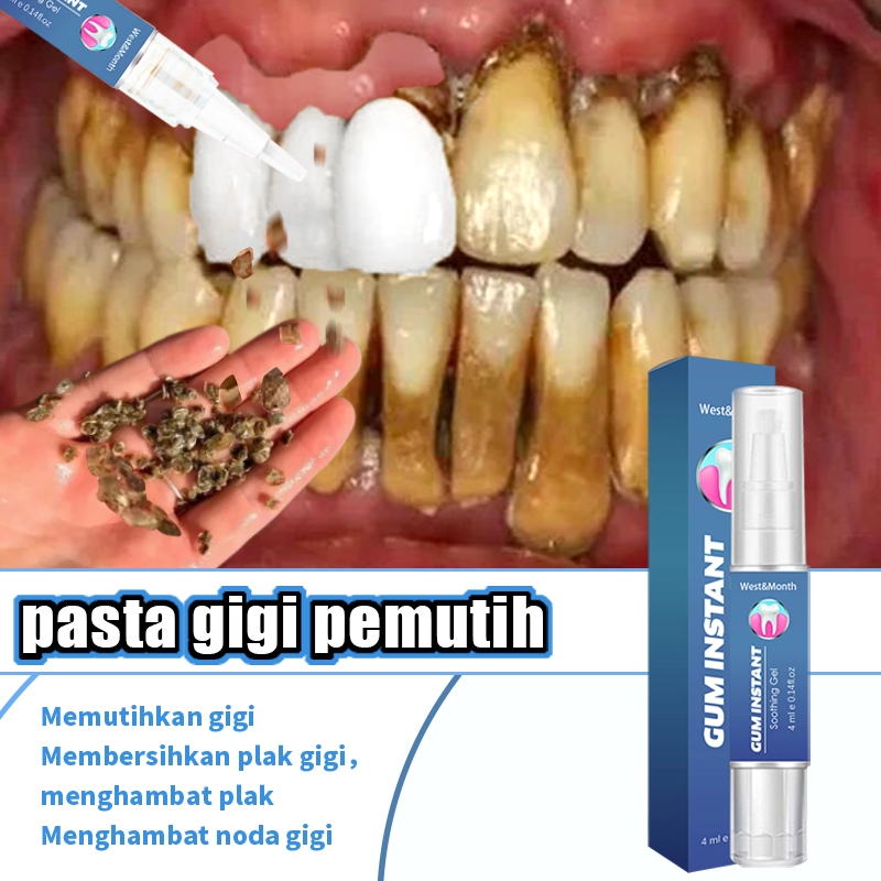 Jual Perontok karang gigi Perontok karang gigi paling ampuh Pasta gigi