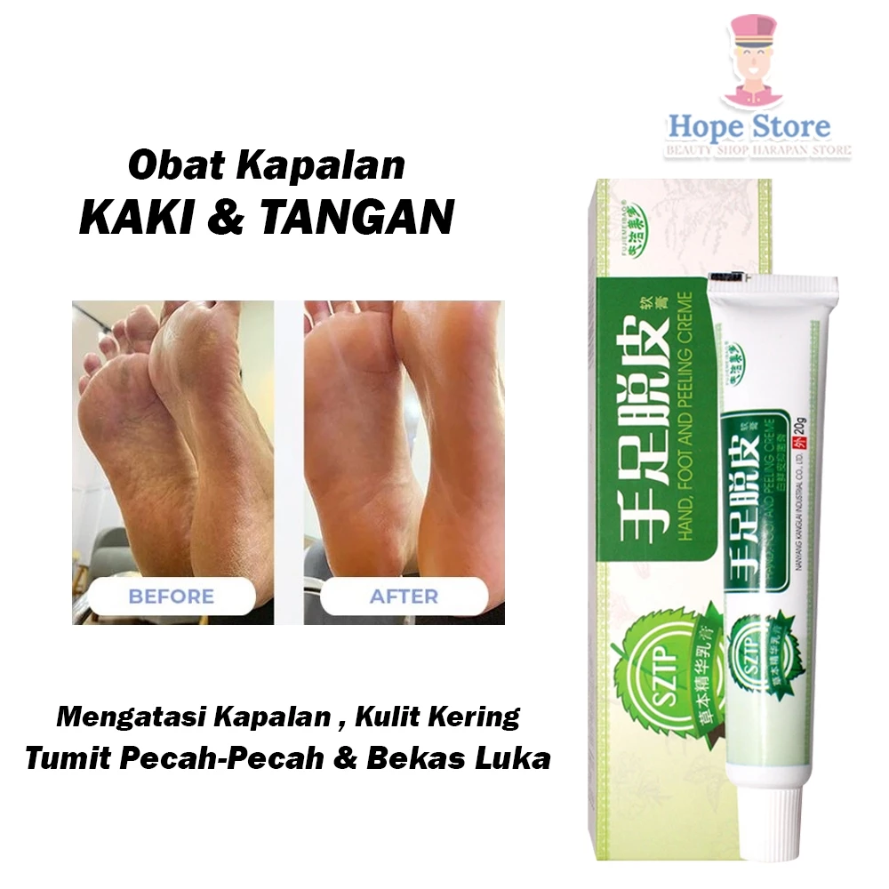Salep Krim Tangan & Kaki Pecah Kasar Kering Kapalan Ampuh 20gr | AutoStock