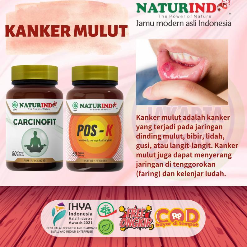 Jual Naturindo Carcinofit Herbal Obat Kanker Payudara Jiank Ganas Benjolan Membantu Memelihara