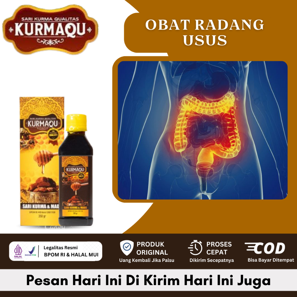 Jual Obat Radang Pada Usus, Gejala Usus Buntu, Radang Usus, Perut