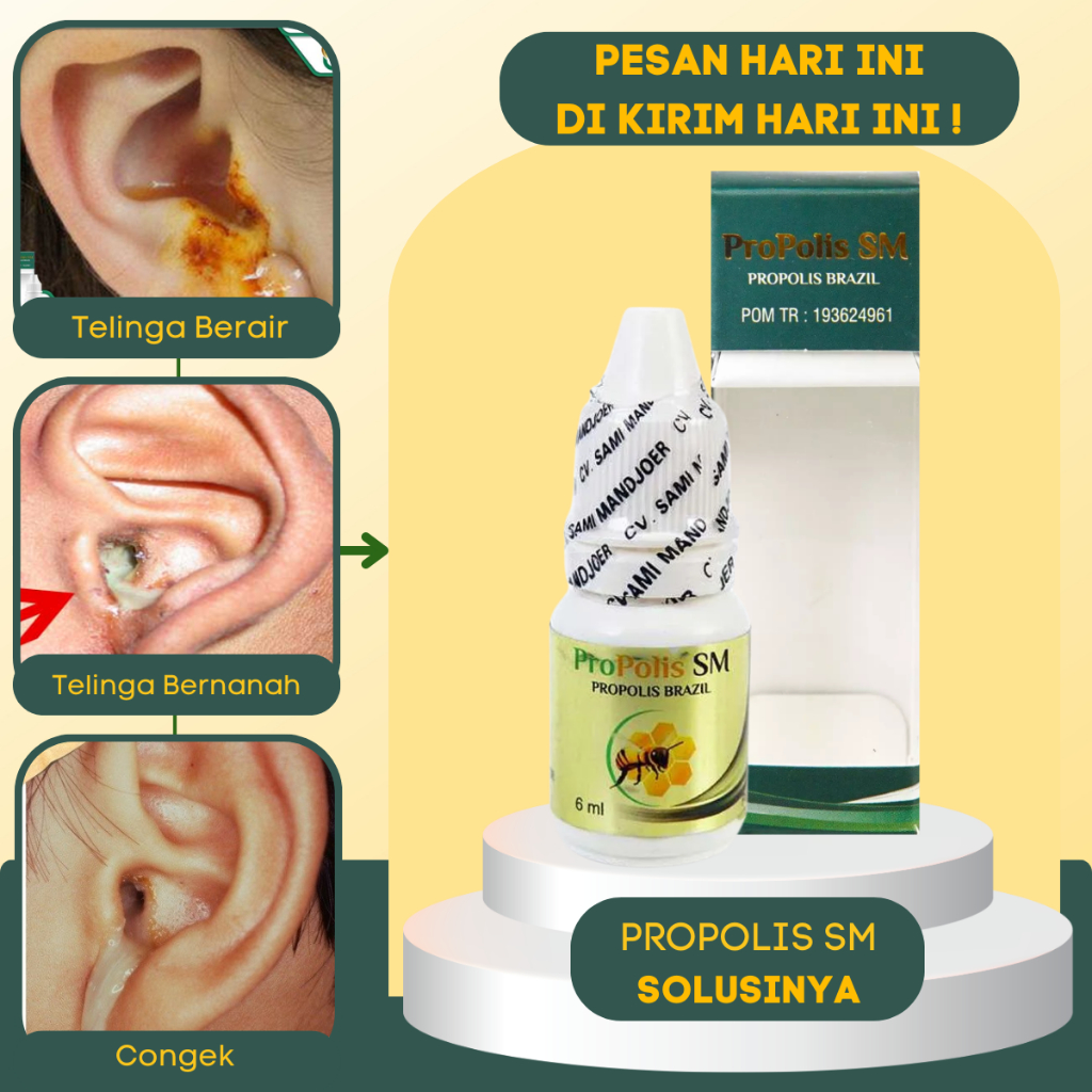 Jual Obat Congek Menahun, Telinga Berair dan Bau, Telinga Bengkak ...