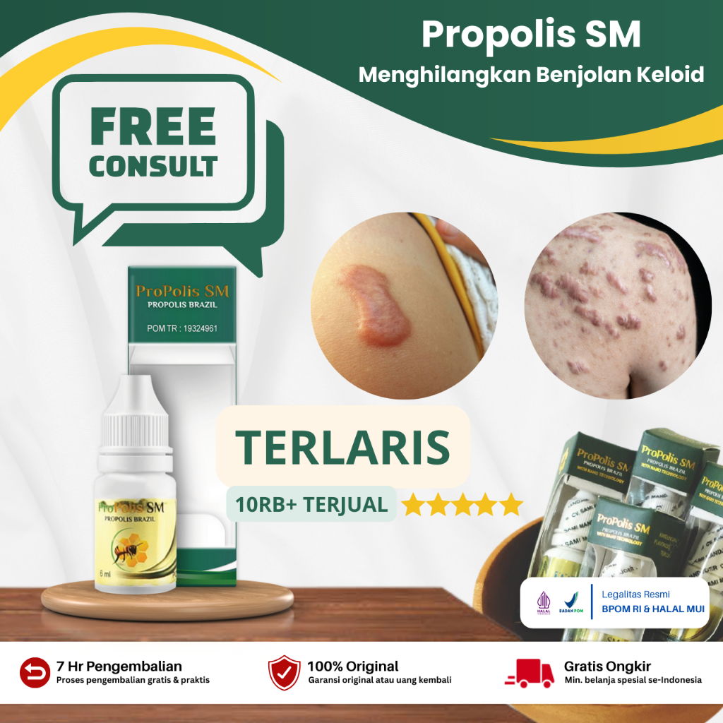 Jual Obat Penghilang Keloid Daging Tumbuh Bekas Luka Operasi Keloid Di