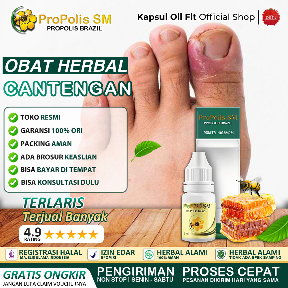 Jual Obat Cantengan Jempol Kuku Tangan Dan Kaki Bengkak Bernanah Bau