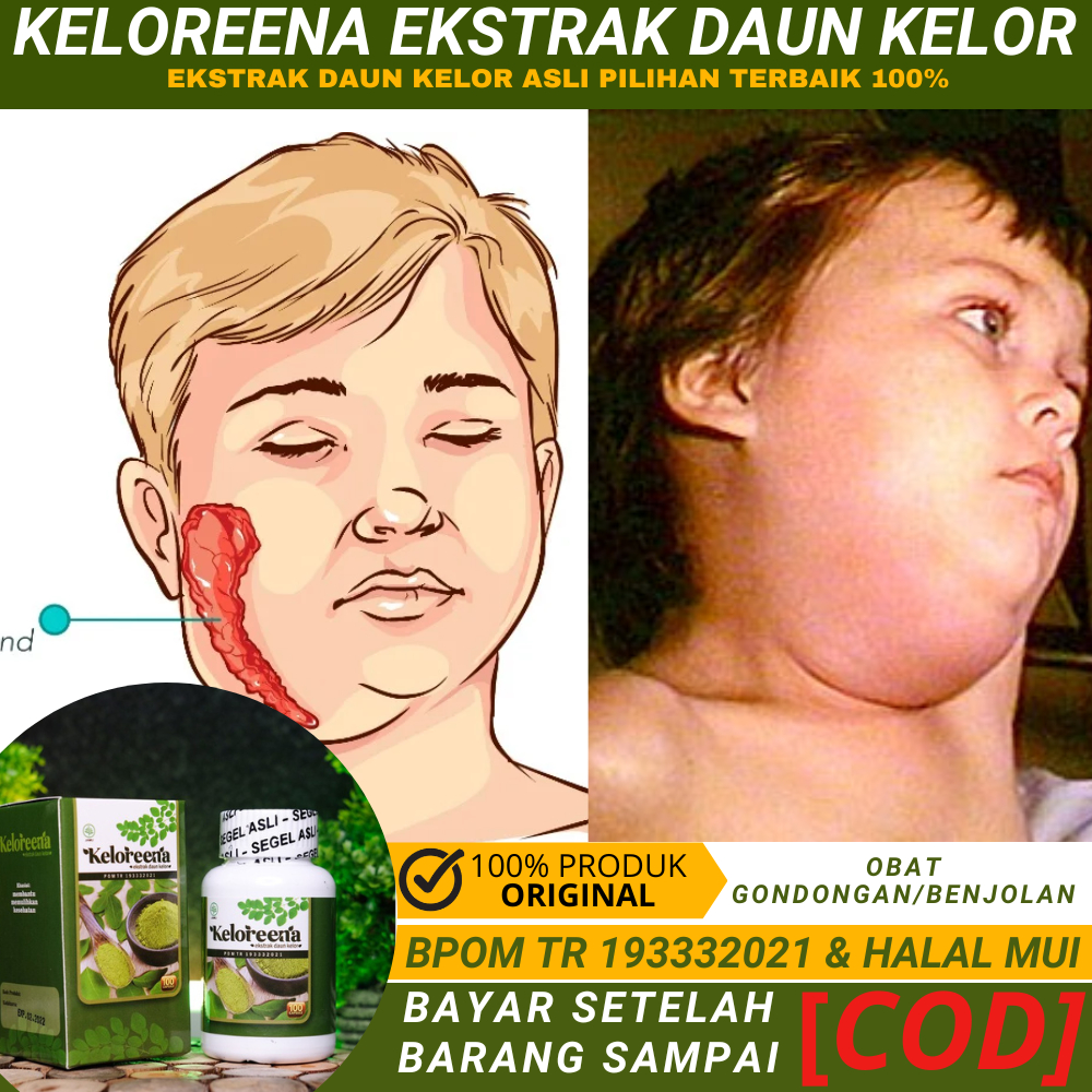 Jual obat kelenjar getah bening, kelenjar tiroid, Kelenjar di Leher