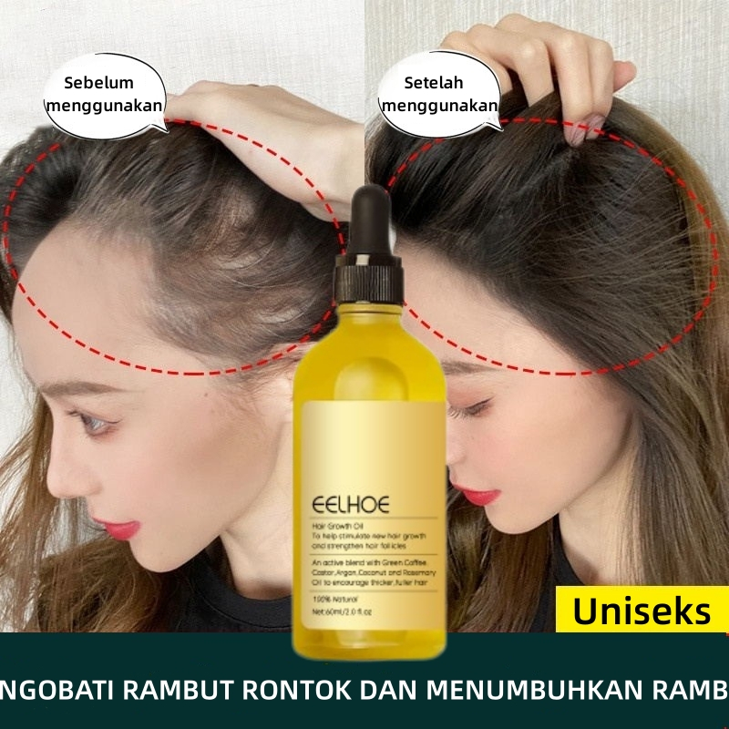 Jual Rosemary Oil Rambut Penumbuh Rambut Botak Perawatan Rambut Rontok