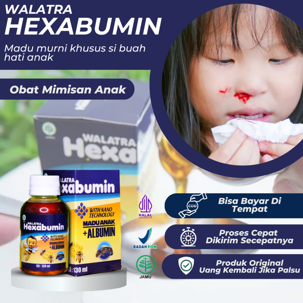 Jual Hexabumin Madu Anak Obat Mimisan Anak, Pendarahan Di Hidung