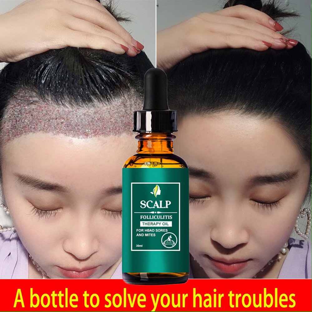 Jual Obat penumbuh rambut penumbuh rambut botak serum penumbuh rambut