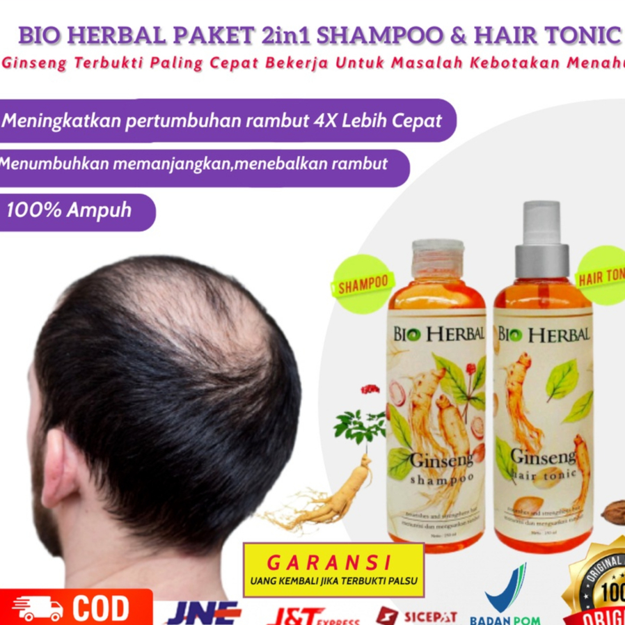 Jual Penumbuh Rambut Rontok Botak Penyubur Penebal Pemanjang Rambut ...