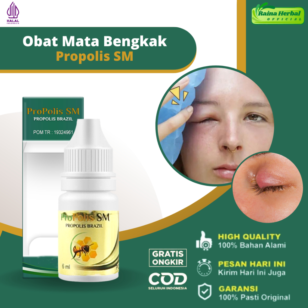 Jual Obat Kelopak Mata Bengkak Obat Mata Kalazion Obat Mata Bintitan ...