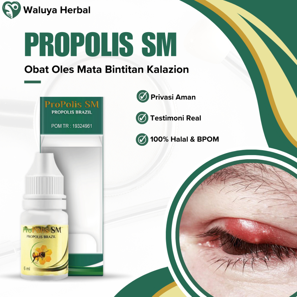 Jual Obat Oles Mata Bintitan Kalazion, Penghilang Benjolan Di Kelopak ...