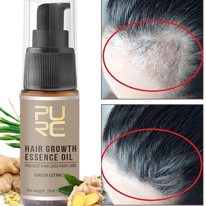 Jual STAR PURC Obat Anti Rontok Penumbuh Rambut Original Pria Wanita ...