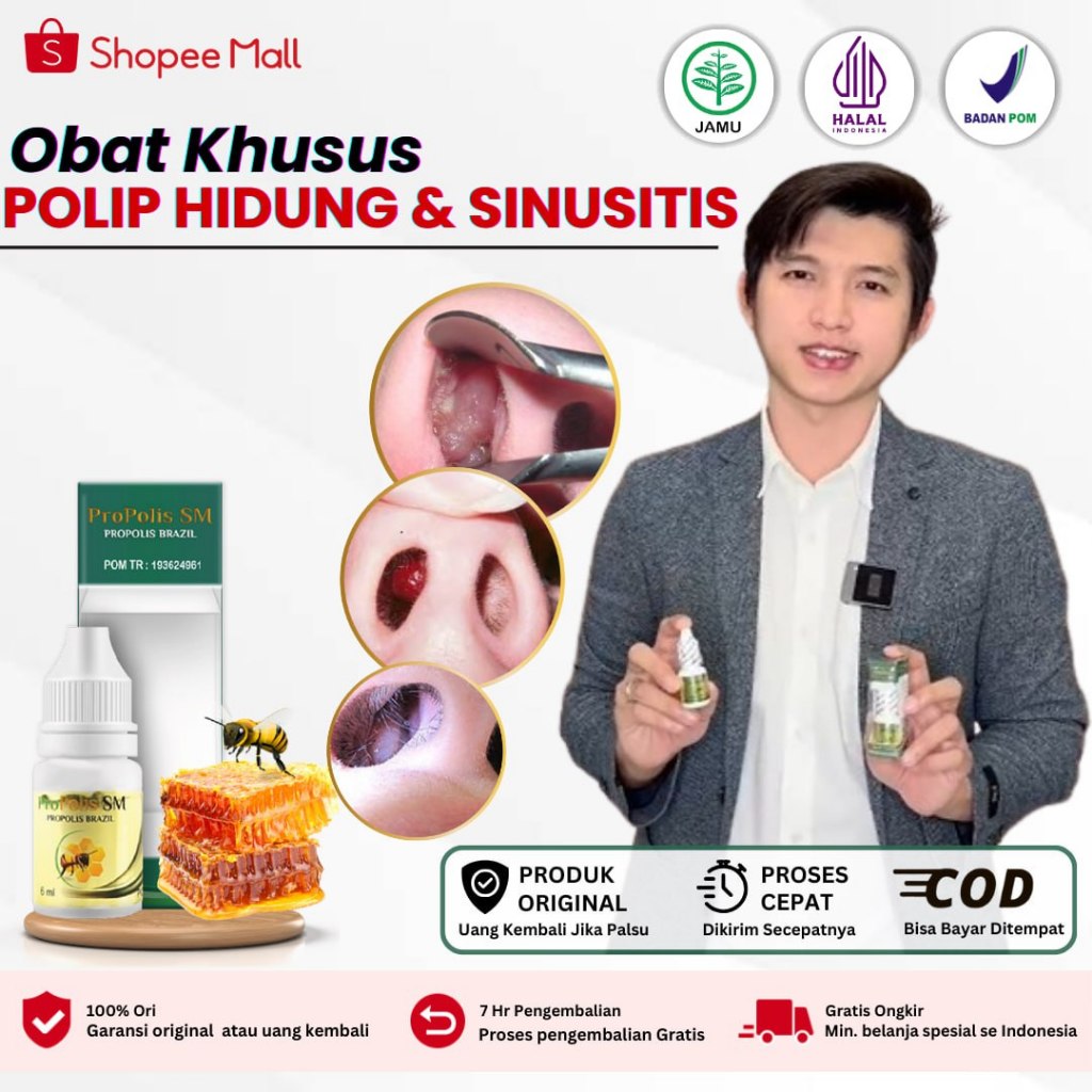 Jual Obat Polip Hidung, Benjolan Didalam Hidung, Tetes Polip Hidung ...