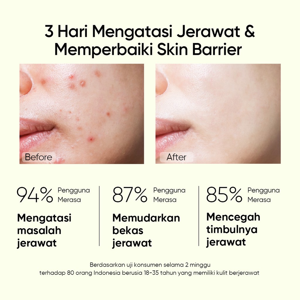 Jual SEGEL Serum SKINTI 2% Salicylic Acid Anti Acne Serum ORIGINAL ...