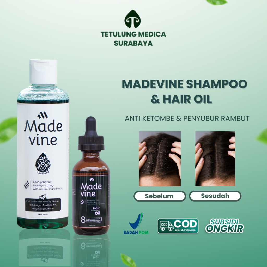 Jual Paket Hair Treatment Madevine Oil And Shampo Anti Ketombe And Penyubur