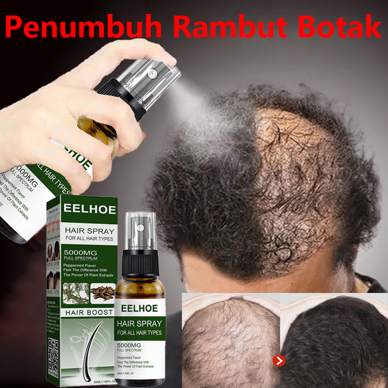 Jual Penumbuh Rambut Botak Semprotan Penumbuh Rambut Obat Rambut Botak ...