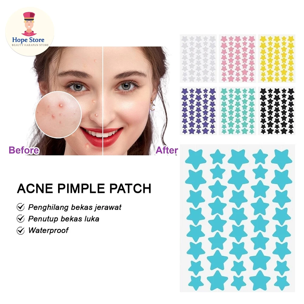 40Pcs - Patch Pimple Patch Acne Patch Model Bintang Stiker Pengangkat Jerawat Tanpa Rasa Sakit | AutoStock