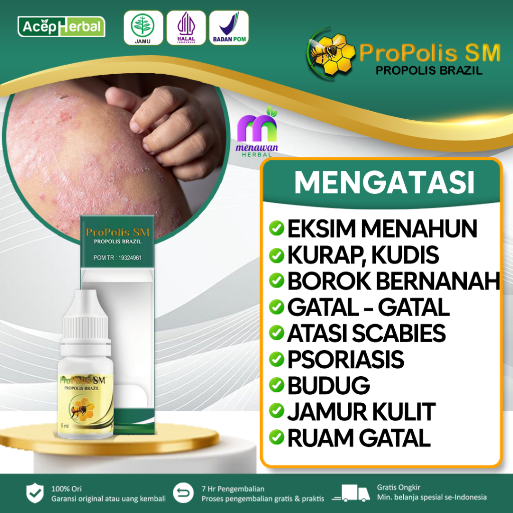 Jual Obat Eksim Basah Kering Menahun Gatal Selangkangan Kurap Kudis