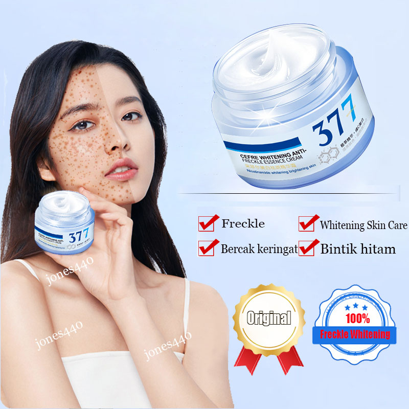 Jual G Whitening Freckle Cream Remove Dark Spots Anti Freckle Cream Niacinamide Fade