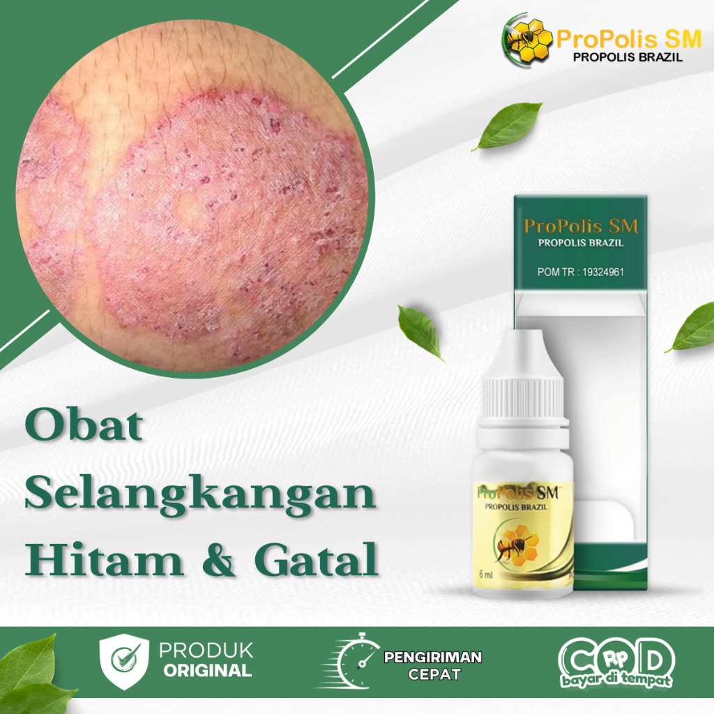 Jual Obat Gatal Selangkangan Dan Hitam, Kurap Selangkangan