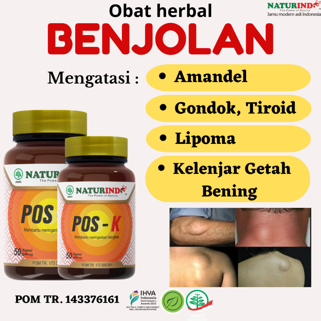 Jual Obat Benjolan Di Leher Payudara Amandel Lipoma Gondok Gusi Bengkak ...