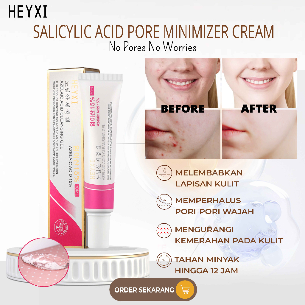 Jual HEYXI Salicylic Acid Pore Minimizer Cream | Krim Pengencang Pori ...