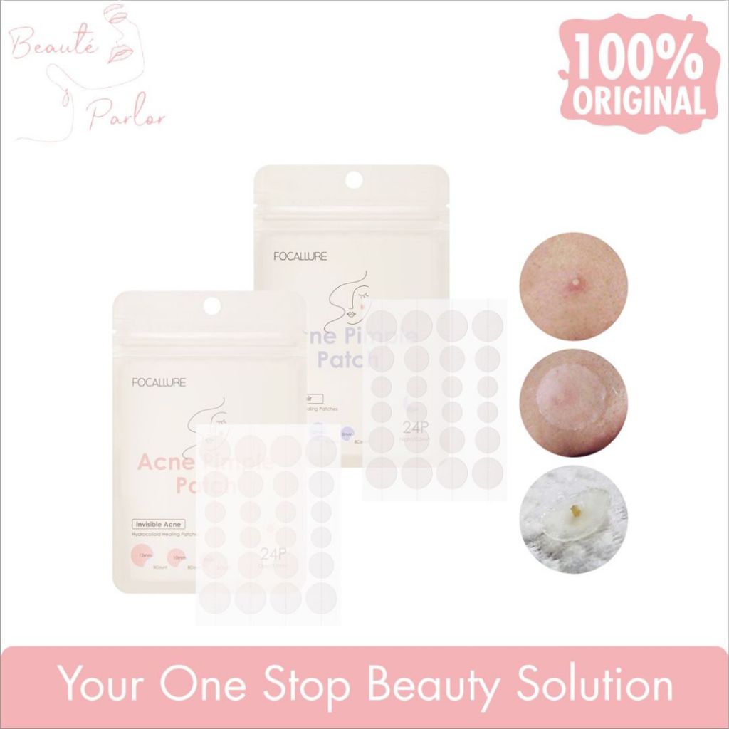 Jual Focallure Spot Patch Acne Treatment Day Night Pimple Spot Waterproof Daily Use Skincare I