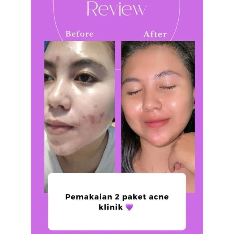 Scarlett Fragrance Serum Brightening Body 170ml Velvet Rouge dan Purple Kiss