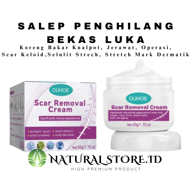 Jual Scar Removal Cream Salep Penghilang Bekas Luka Hitam Penghilang