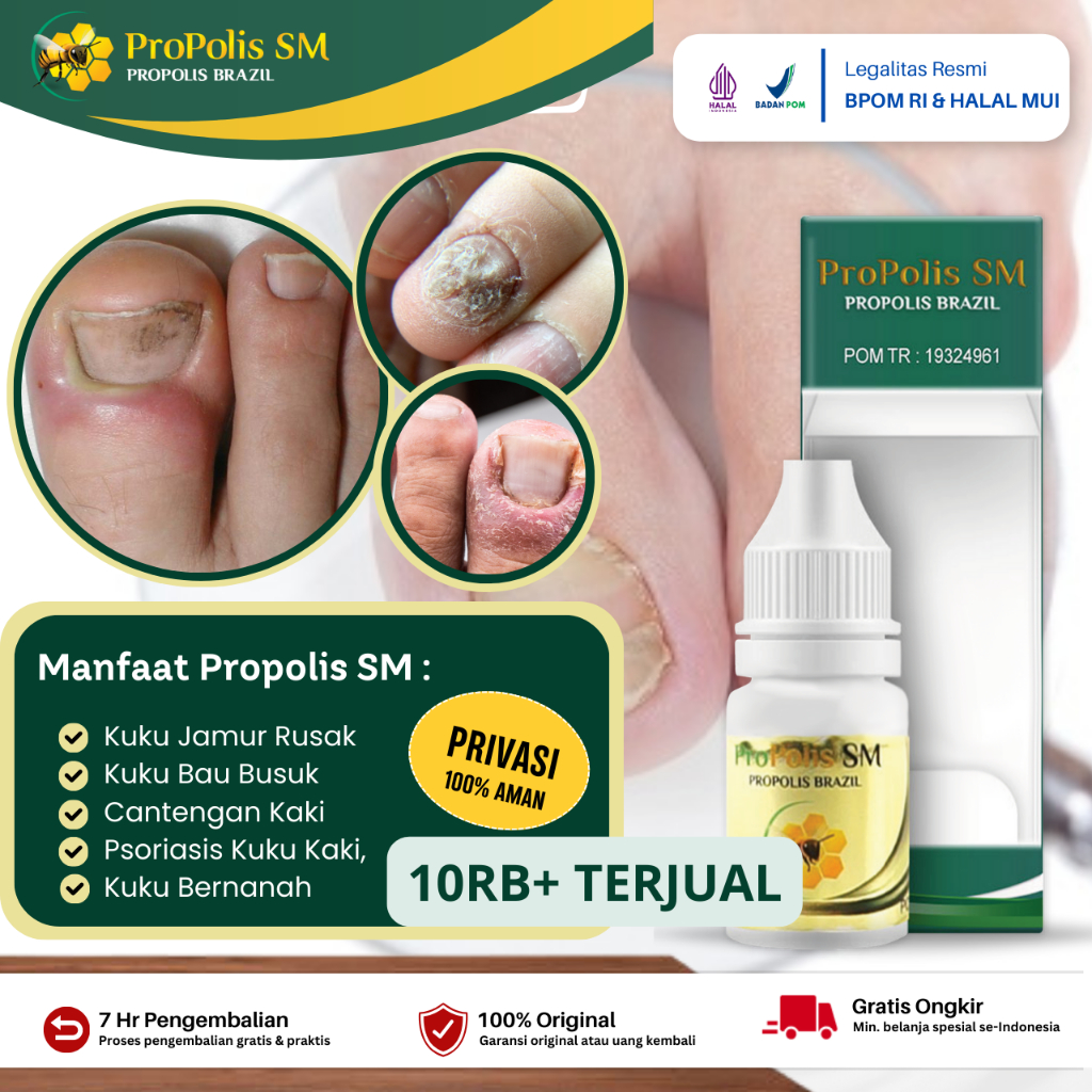 Jual Propolis Sm Obat Kuku Jamur Rusak Kuku Bau Busuk Kaki Jamur