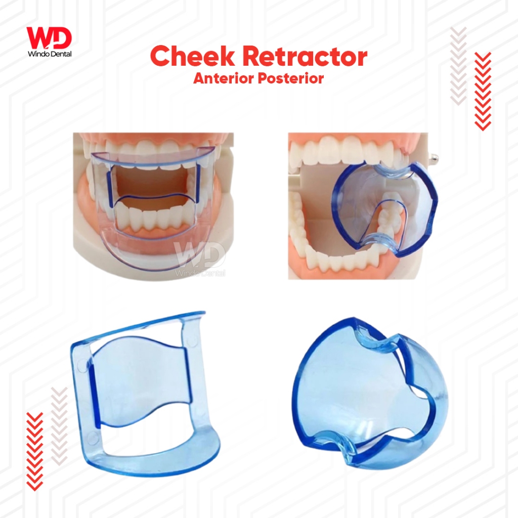 Jual MOUTH OPENER/ BITE BLOCK RETRACTOR / RETRAKTOR LIDAH MUKOSA ...