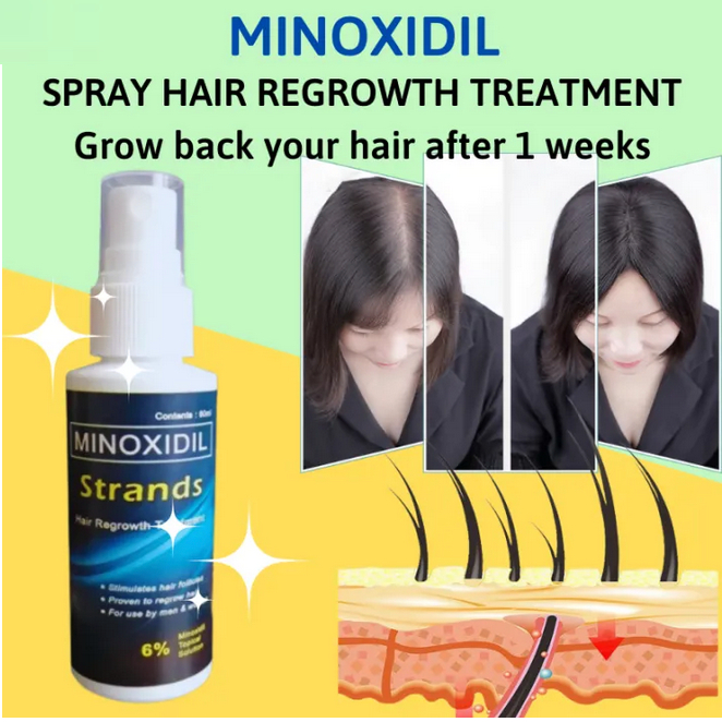 Jual Minoxidil Strands 6% Minoxidil Kirkland Minoxidil Original Topical ...