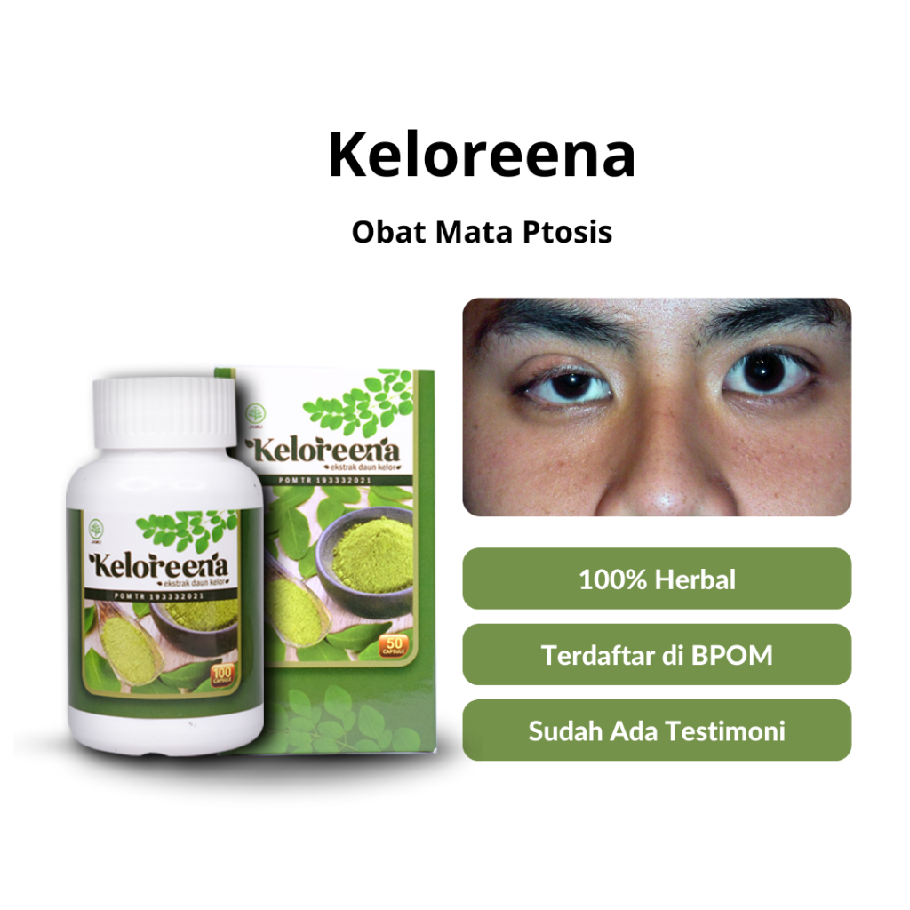 Jual Obat Mata Ptosis Kelopak Mata Turun Mata Sipit Sebelah Mata