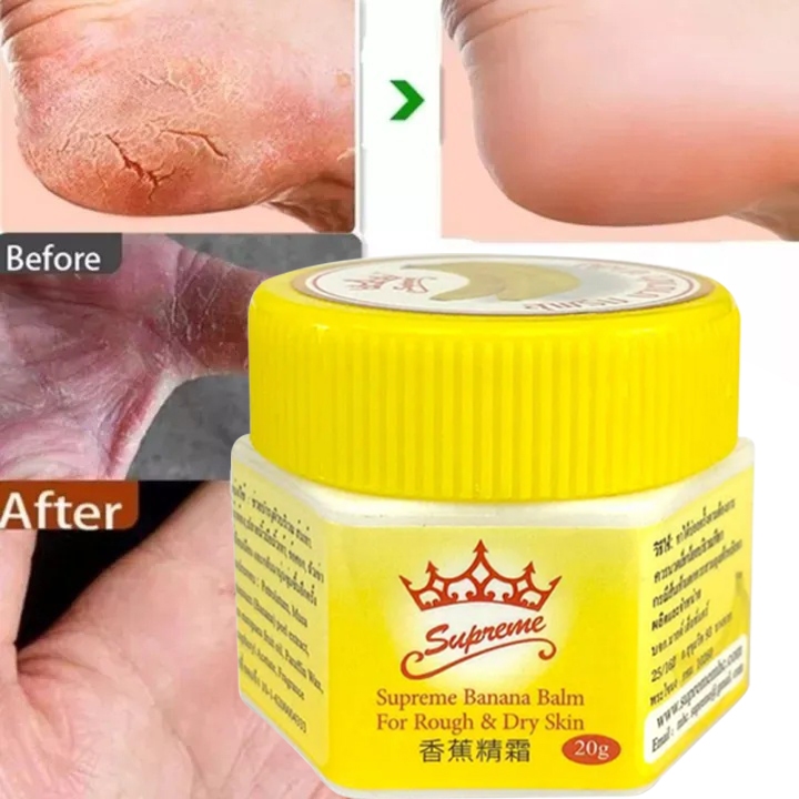 Jual Thailand Banana Foot Cream Tangan Krim Kaki Anti-Chafing Kulit