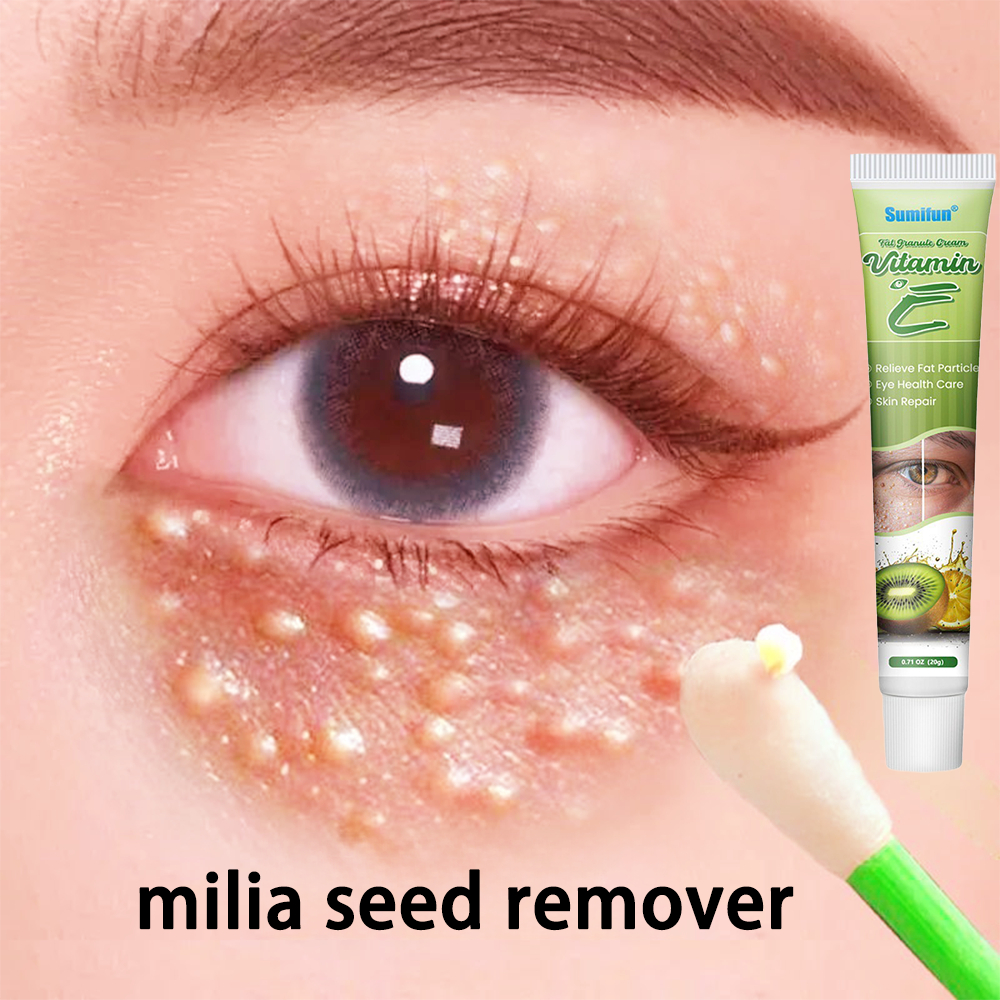 Jual obat milia di bawah mata cream milia penghilang milia Eye cream obat milia remover Benjolan