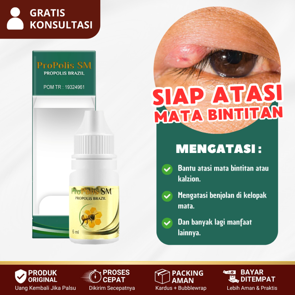 Jual Obat Kalazion, Bintitan, Obat Benjolan Di Kelopak Mata, Bisul Mata ...