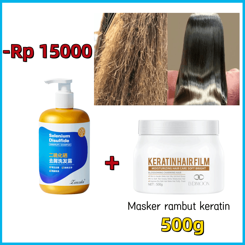 Jual Shampoo anti ketombe Sampo ketombe Selenium sulfide Anti dandruff