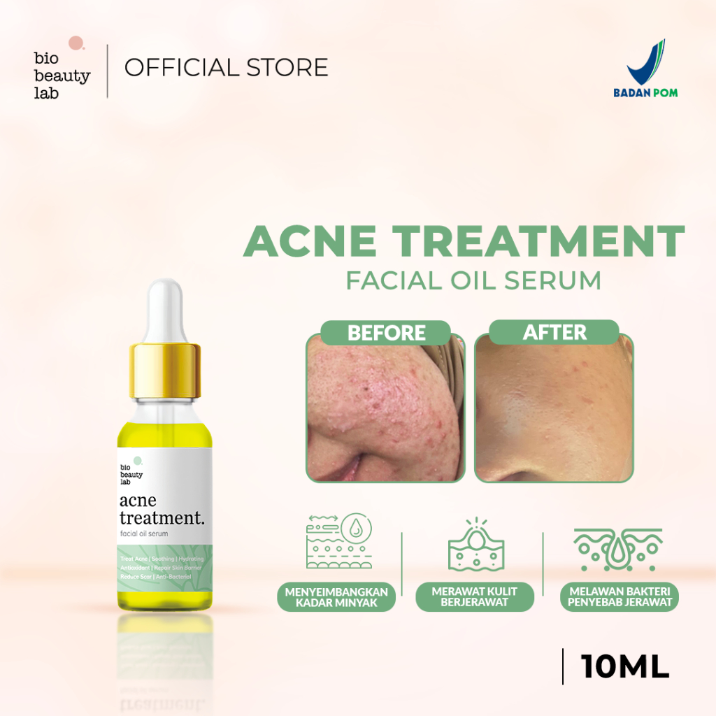 Jual Bio Beauty Lab 10ml Acne Treatment (HEALING) Facial Oil Serum Shopee Indonesia