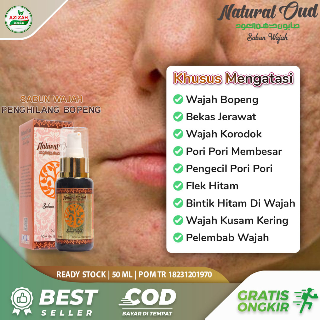 Jual Obat Penghilang Bopeng Bekas Jerawat Pengecil Pori Pori Wajah ...