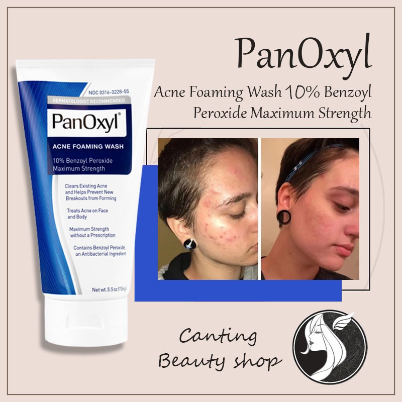 Jual PanOxyl Acne Foaming Wash Benzoyl Peroxide 10%/4% Maximum Strength ...