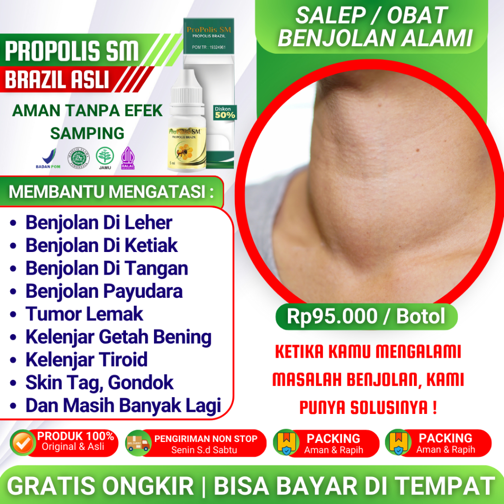 Jual (Terlaris) Obat Penyakit Gondok Beracun Tiroid Di Leher Gondongan